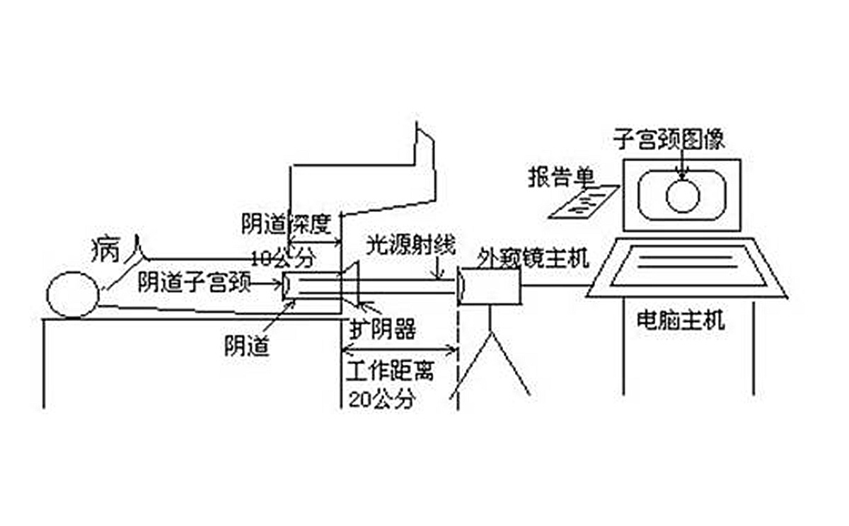 如何使用數碼電子陰道鏡?